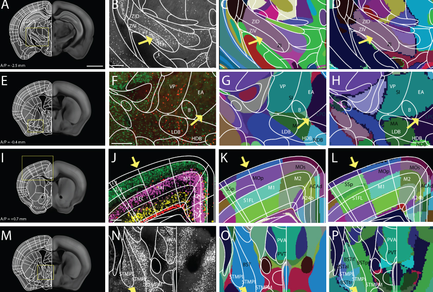 Grid of views of mouse brain: 3D and areas mapped in color