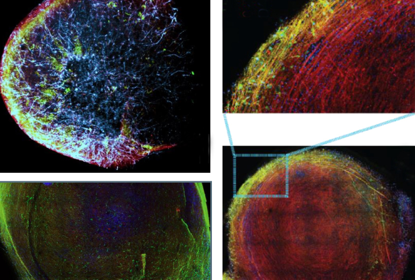 Group of four organoid images