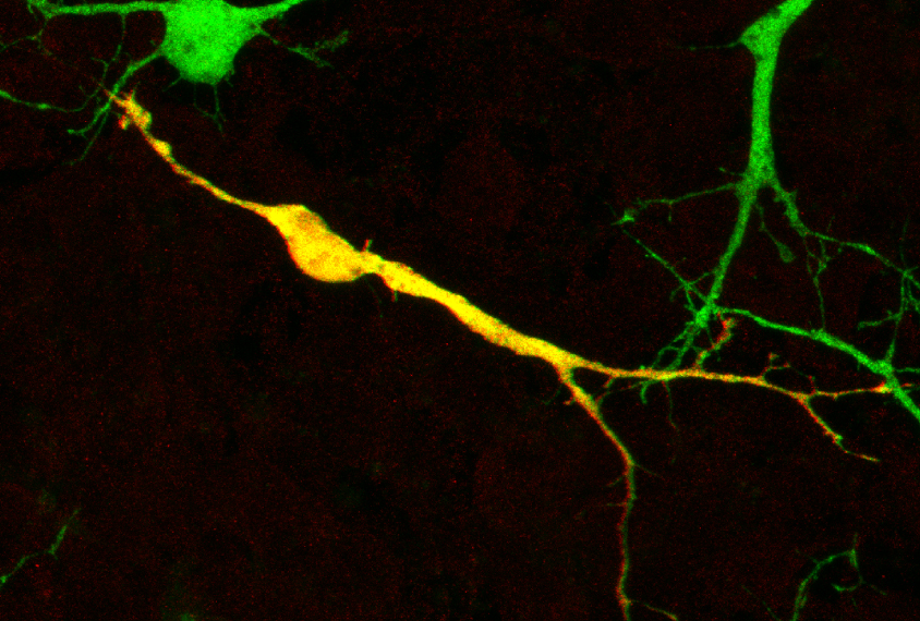Neurons in a mouse brain are highlighted green and yellow