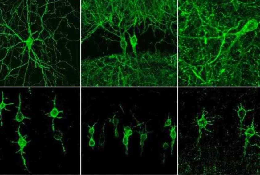 Group of images of neurons glow green