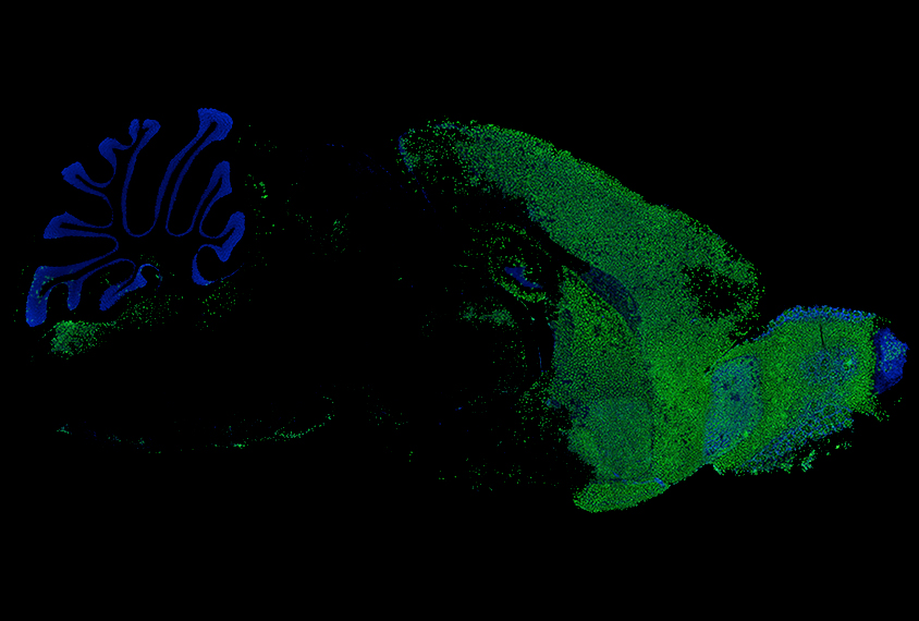 Micrograph of mouse brain showing transplanted human microglia