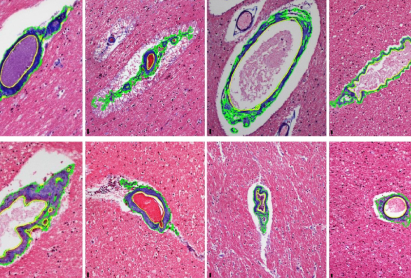 micrographs of blood vessels in the brain