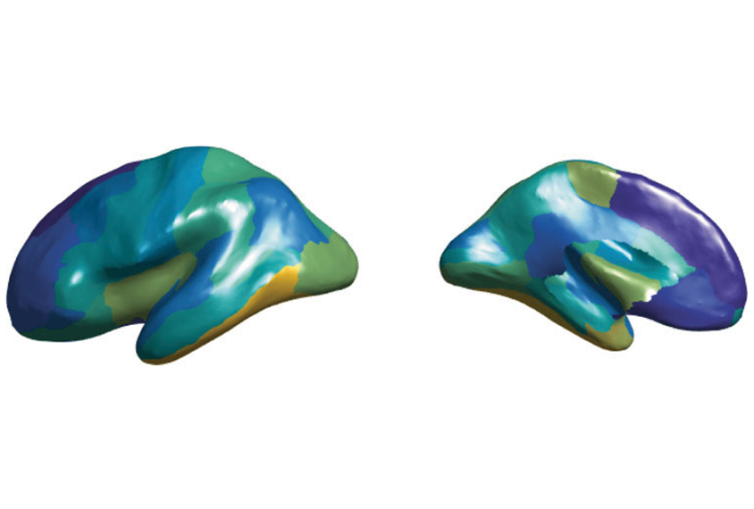 Two sides of a 3D human brain showing different areas highlighted in various colors