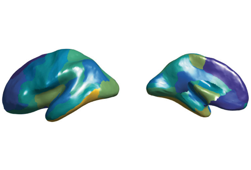 Two sides of a 3D human brain showing different areas highlighted in various colors