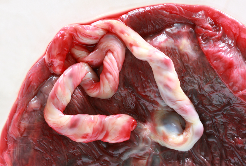 umbilical cord and placenta