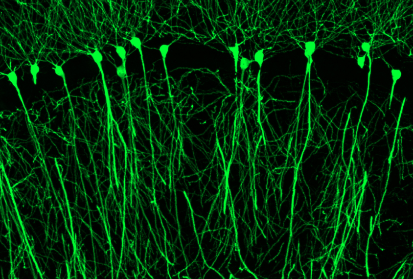 Mice neurons seen in green