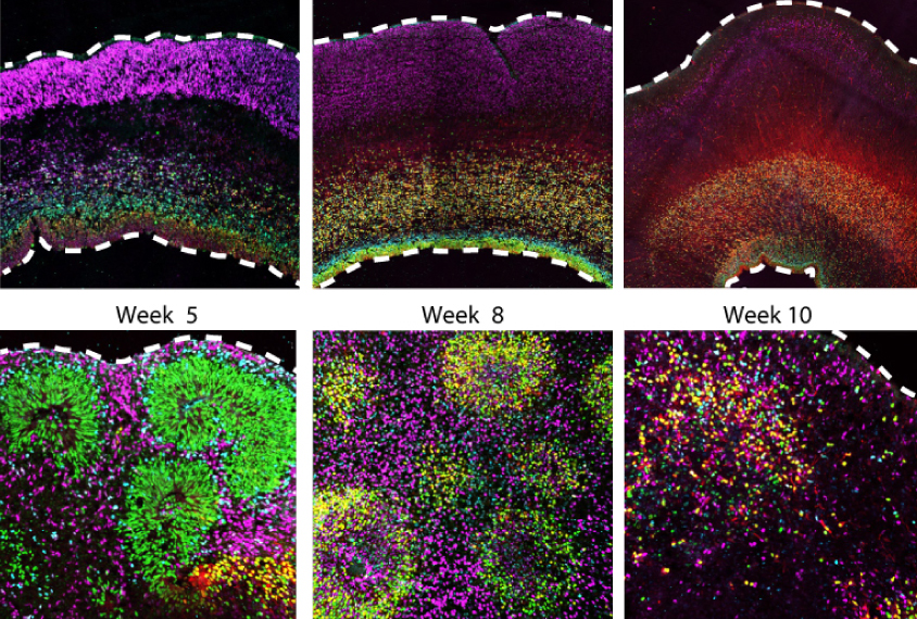 Brain organoid cells look different than those in embryonic brain tissue-grid of six images show growth of both types over time.