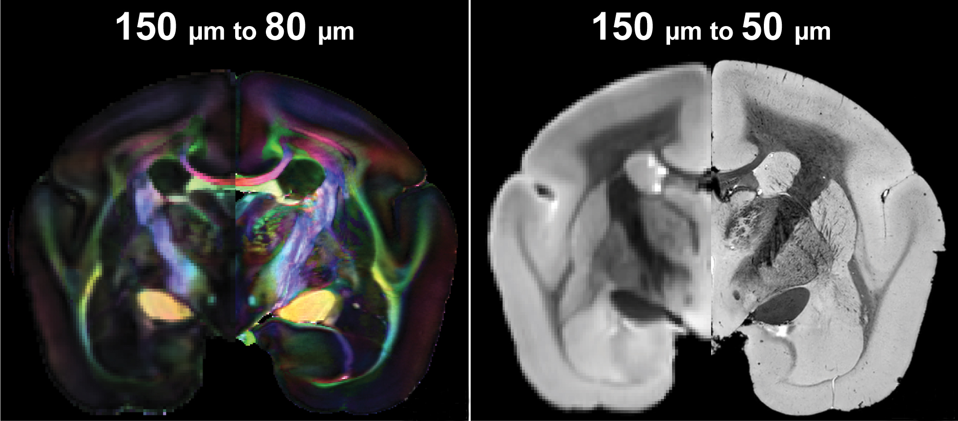 two panels, one color and one black and white show two types of imaging on each half.