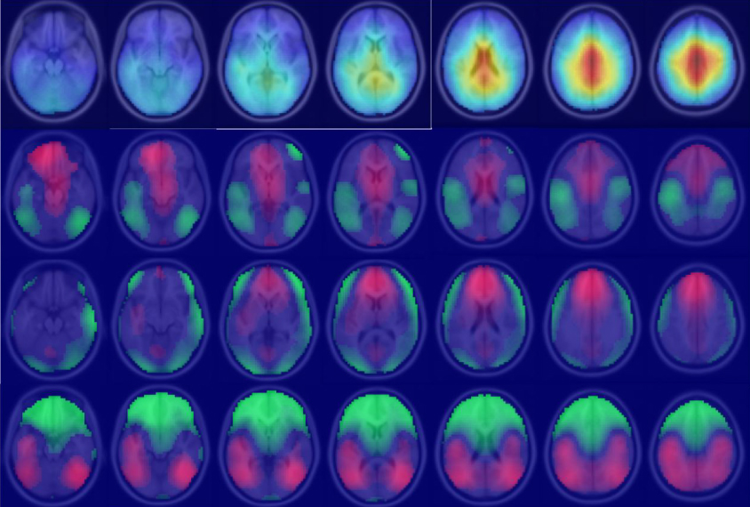 multiple brain scans showing brain activity during different tasks. Purple background and brains in pink, red and green tones indicate activity.