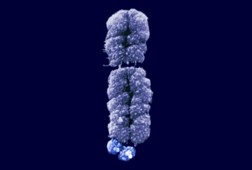 Microscope image of Fragile X chromosome