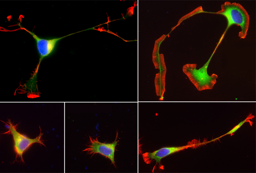 Microscopic view of neurons