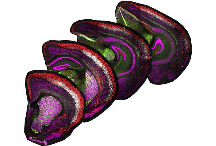 brain shown in four distinct, colorful layers