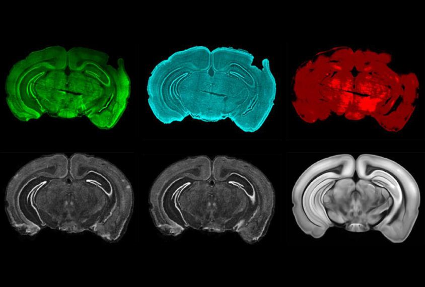 grid of six brain slices in different staining methods.