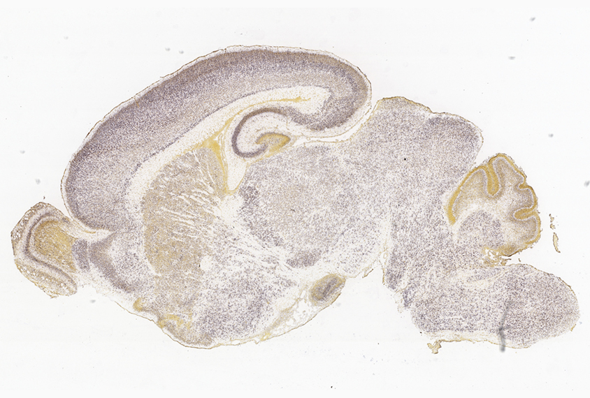 micrograph of a slice of mouse brain