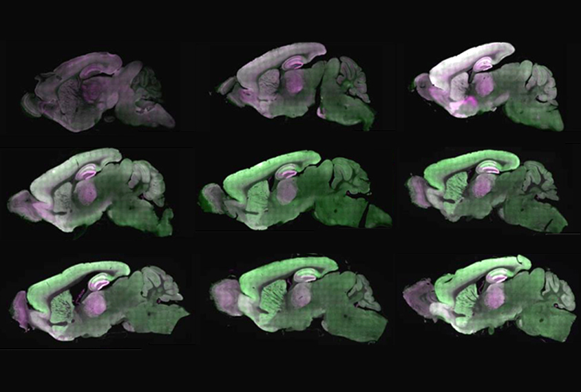Mouse brain images show proteins in mouse brains at different ages.