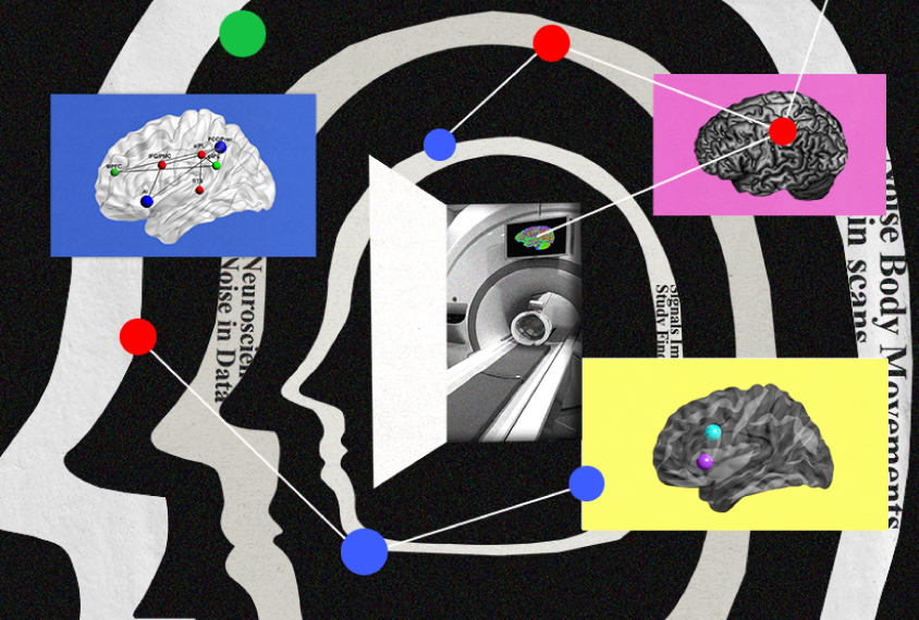 Collage showing head movements that create noise, an MRI machine, and brain images.
