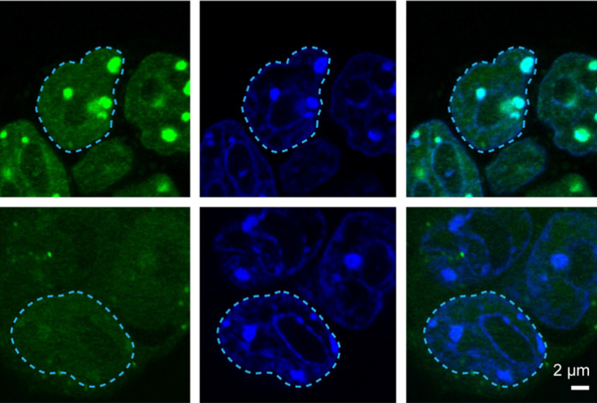 Series of micrographs showing neurons with Rett syndrome mutations lacking liquid compartments around DNA.