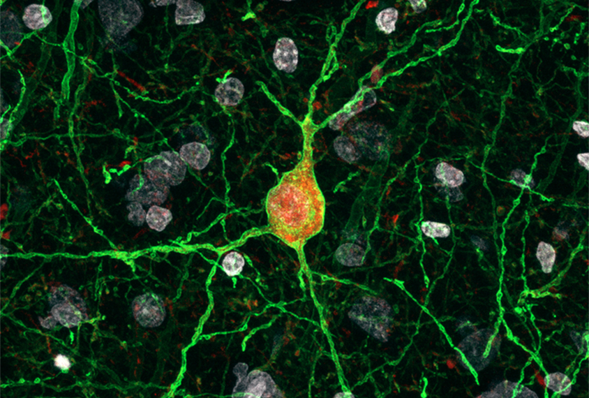 Neurons in a macaque cortex express parvalbumin in red.