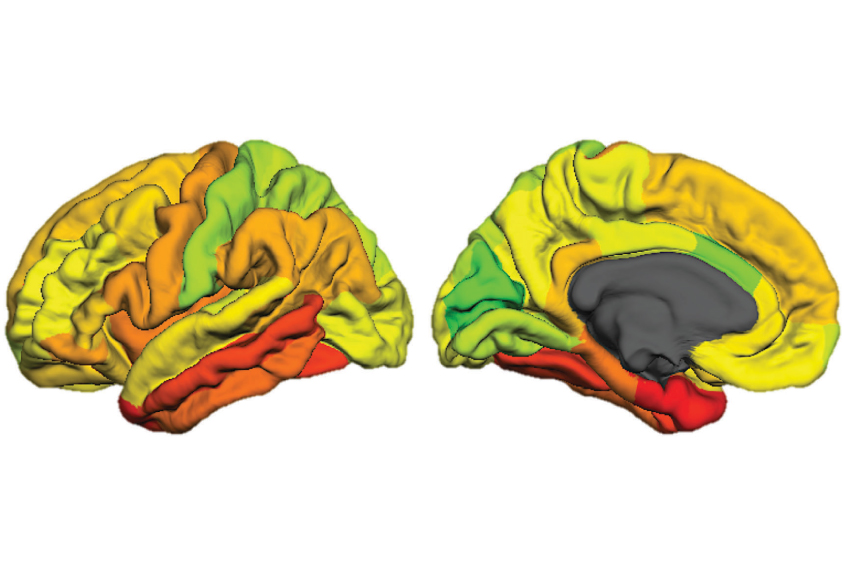 Brain hemispheres color-coded.