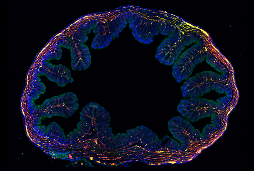 Gut neurons and glia (red, green) are fragile and interwoven with other cells (blue) in the colon, making them tricky to isolate.