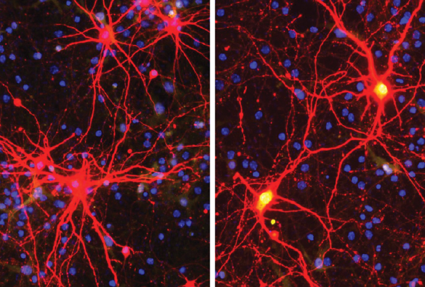 Micrograph of nerve cells being targeted by CRISPR enzyme to activate the silenced gene in Angelman syndrome