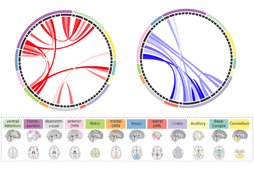 Brain diagrams showing connectivity within different regions.