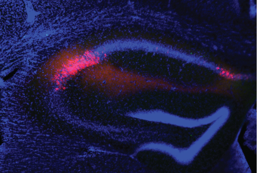 Protein in brain