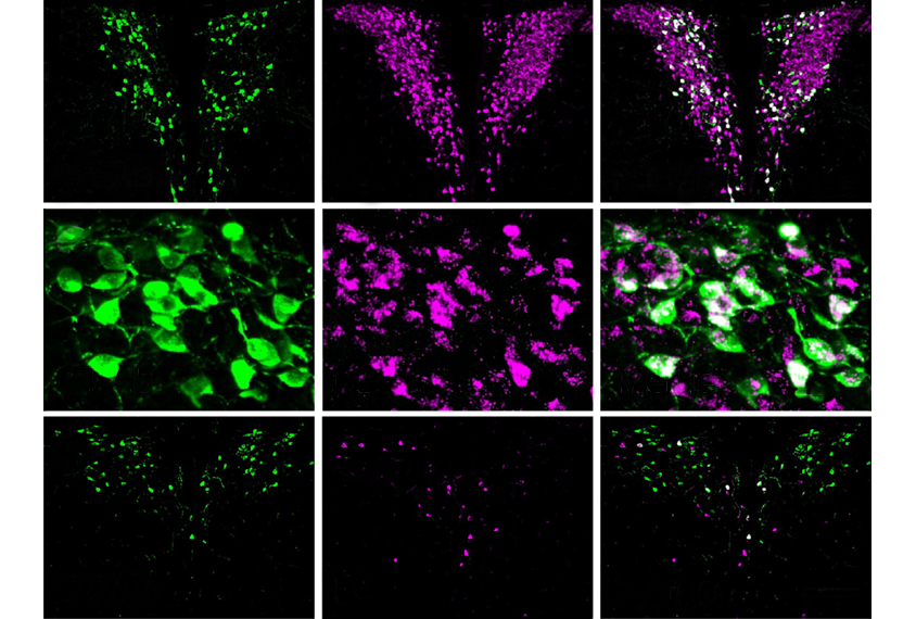 Oxytocin neurons stained pink and green.