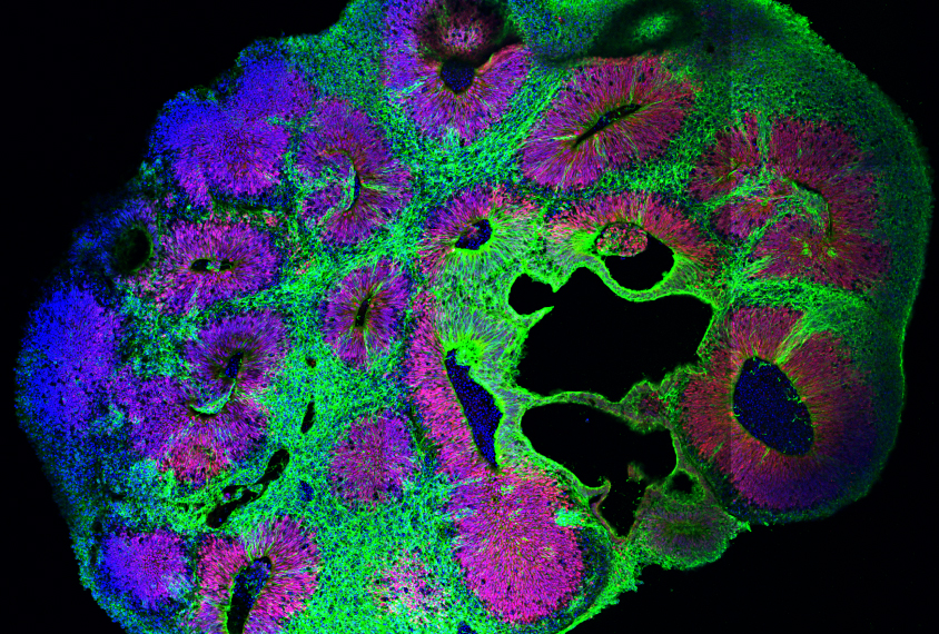 Brain organoid with multiple stains; red and green, to indicate cells.