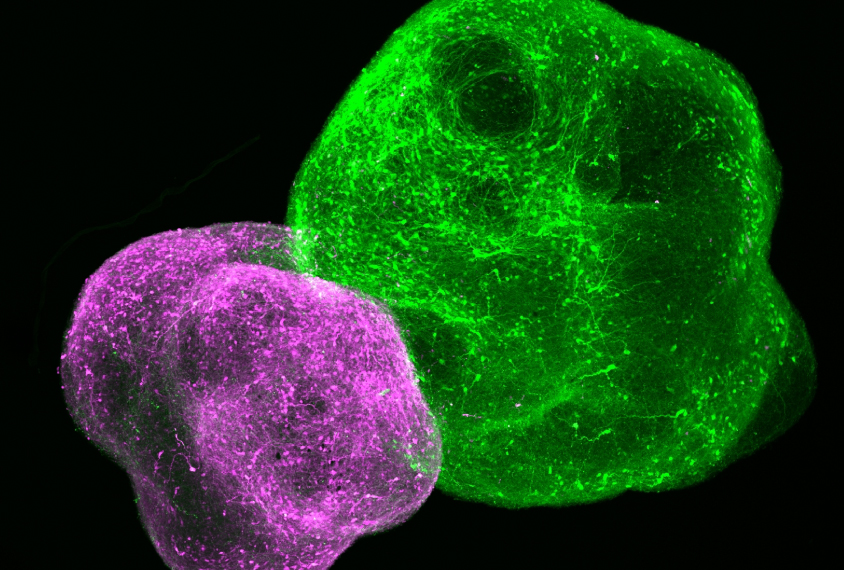 In cortical-striatal assembloids, striatal neurons (magenta) derived from individuals with Phelan-McDermid syndrome fire more frequently than neurons from controls.