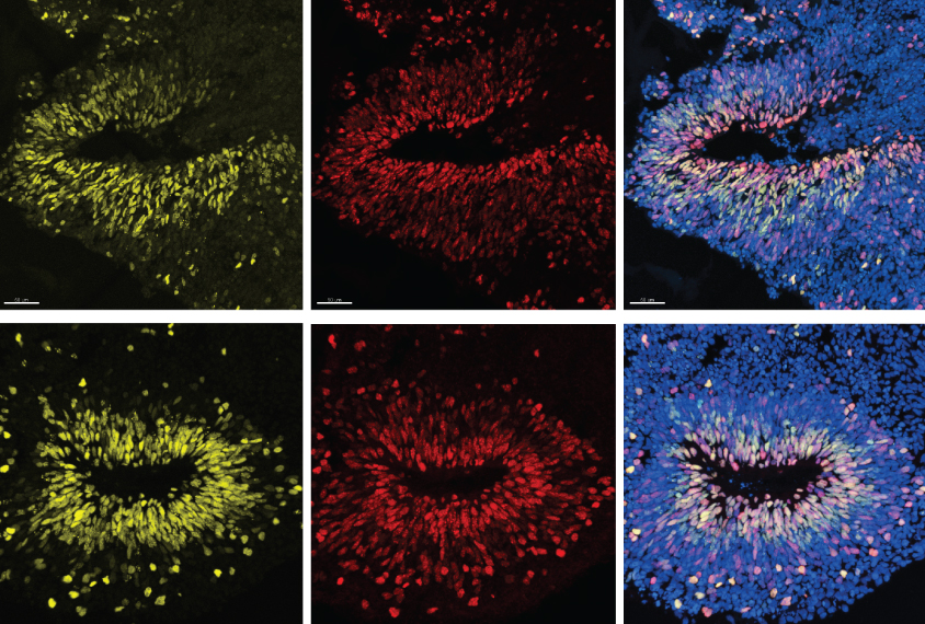 organoids in early stages of development.