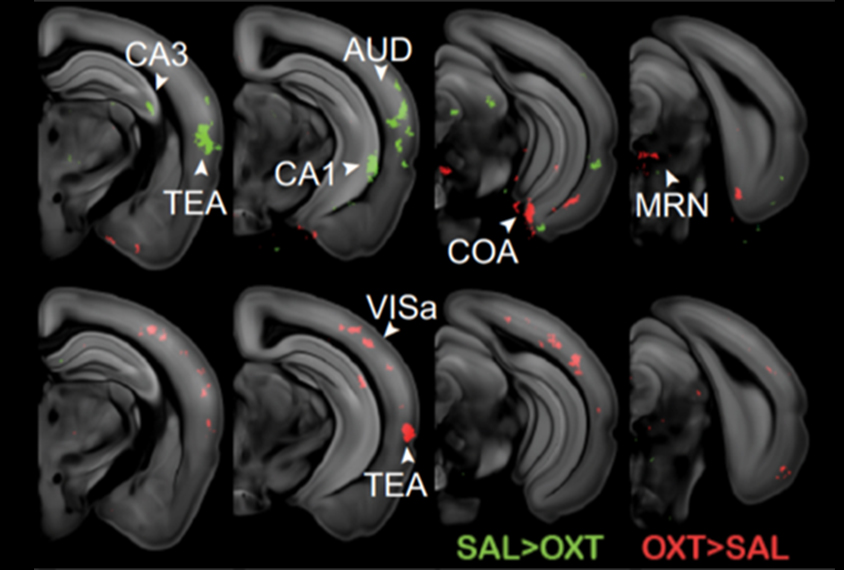 Scans of mouse brain slices showing differences in oxytocin levels