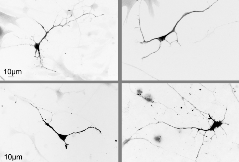 Neurons show structural changes, seen in black and white.