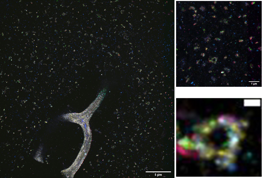 Proteins present at neuronal junctions.