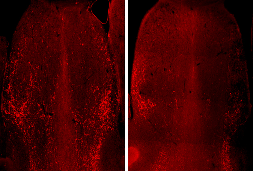 Mouse brain slices shown in red