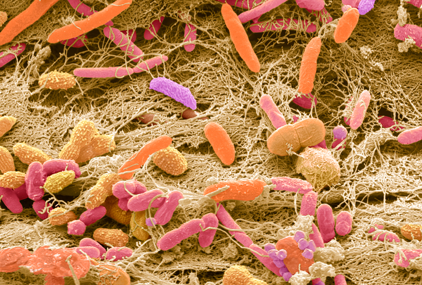 SEM of faecal bacteria.