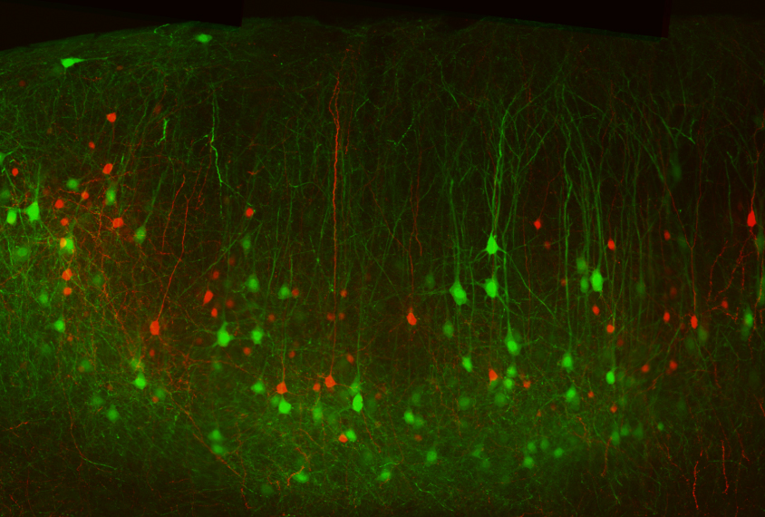 cells in a mouse brain show the mutations in green.