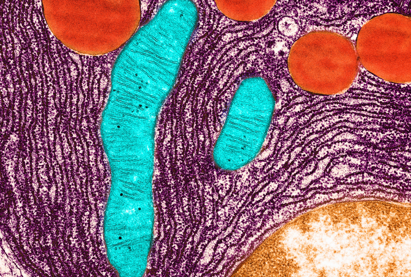 Transmission Electron micrograph shows mitochondria colored an aqua blue.