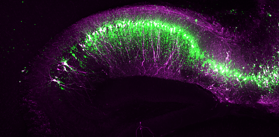 mouse brain neurons highlighted pink and green.