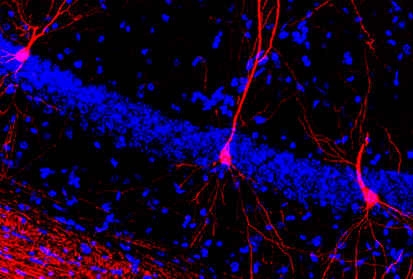 Mouse brain neurons labeled with a genetic marker show pink on a dramatic blue background.