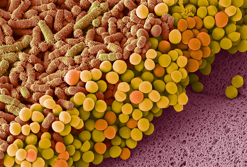 Scanning elecgron micrograph of Faecal bacteria.