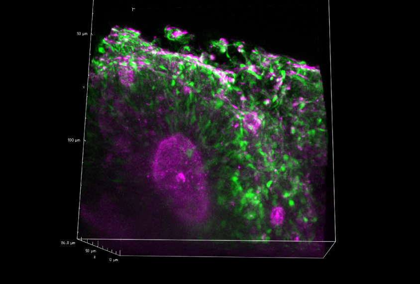 By imaging spheroids in 3D, researchers can see structures called rosettes, in which immature brain cells (green) surround a cavity (pink), of a variety of shapes and sizes.
