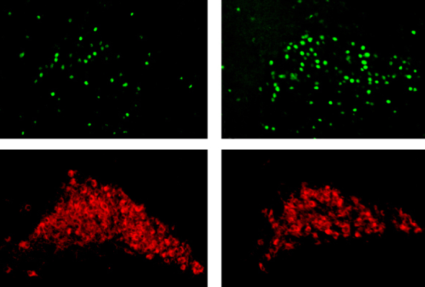 Micrograph comparing locus coeruleus of 16p11.2 mutant mice and control mice show less active noradrenergic neurons in mutant mice.