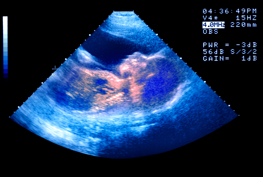 Ultrasound of a human fetus.