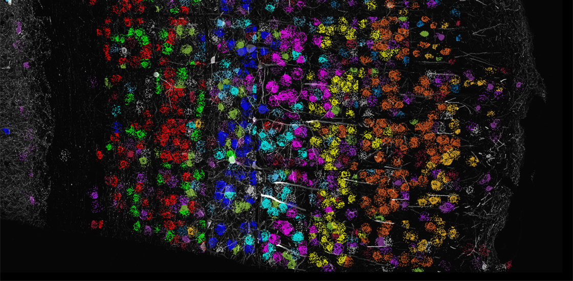 A rainbow of RNA in mouse brain slice
