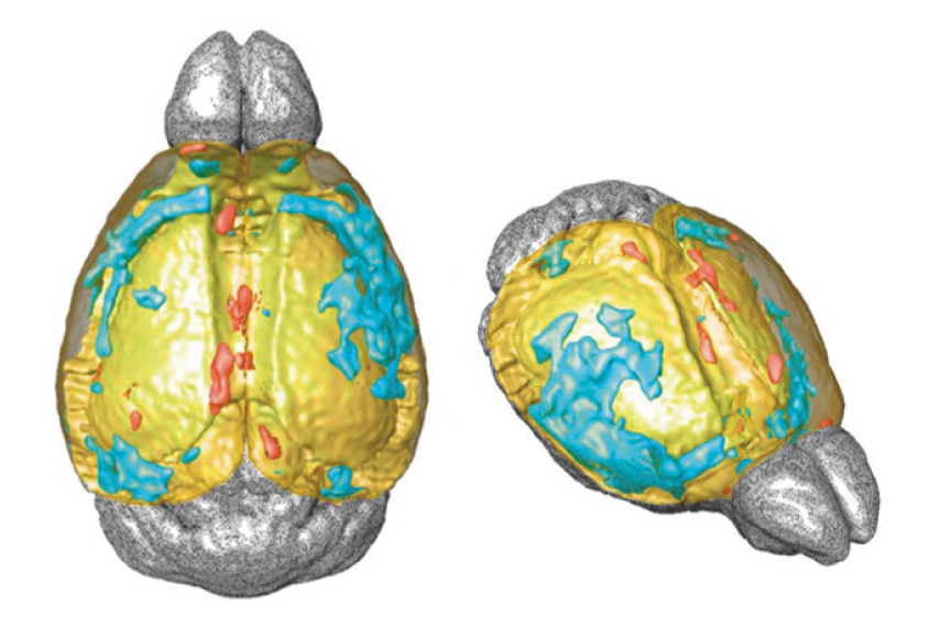 Mouse brains carrying CUL3 gene mutation reveal unusually thin cortical tissue.