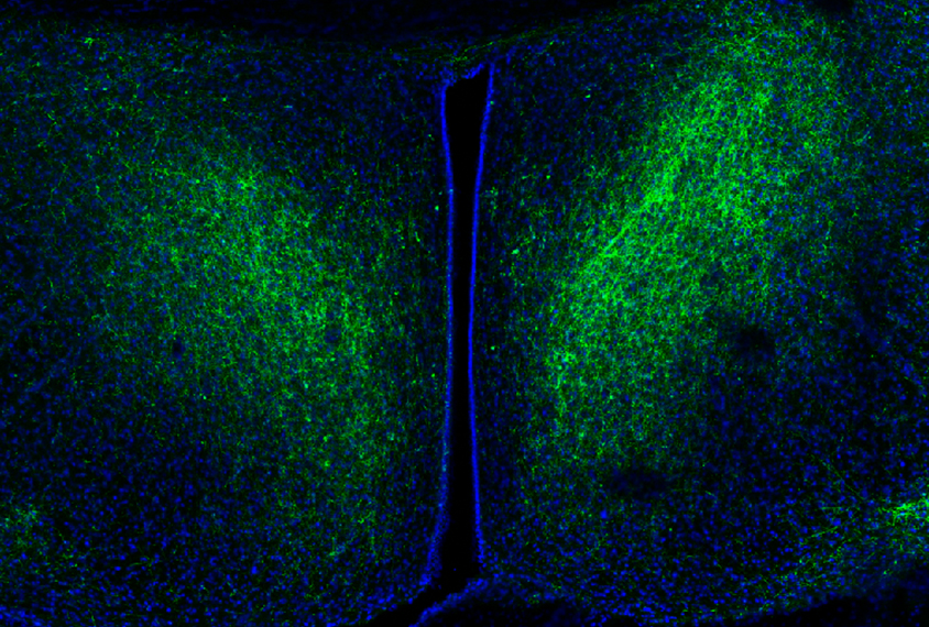 Brain scan showing communication from amygdala to hypothalamus about social reward.