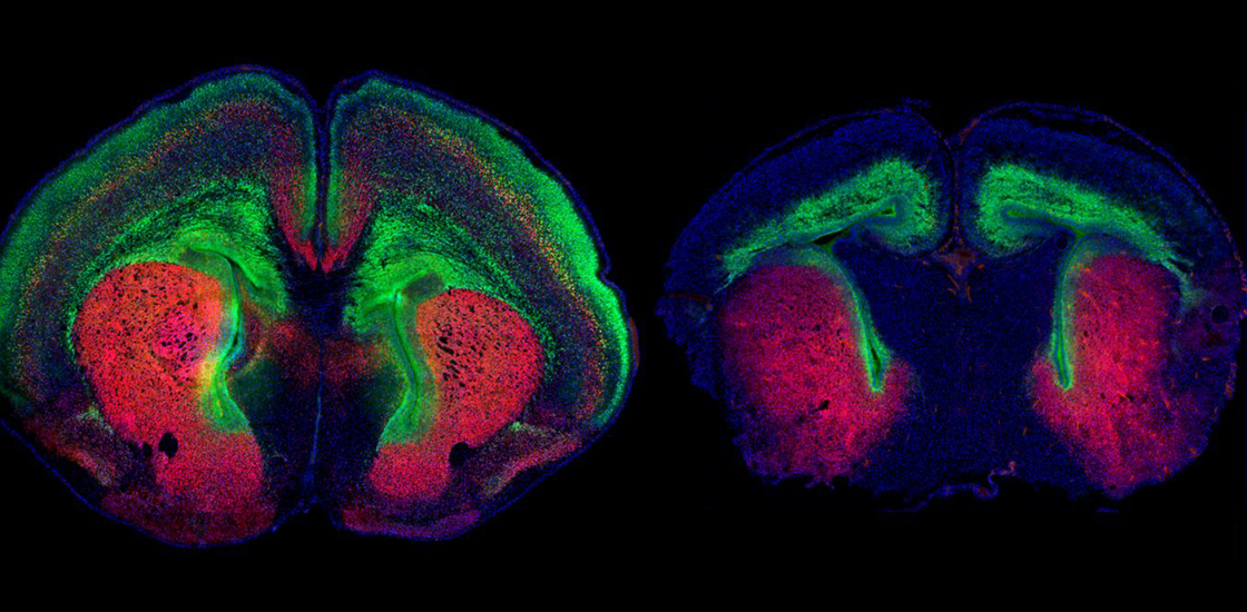 Two views of mouse brain slices colorized in green and red.