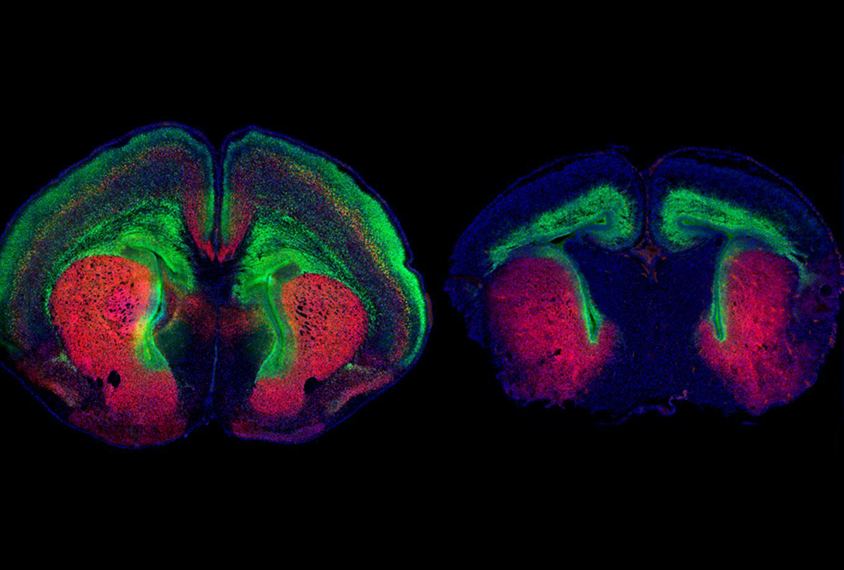 Two views of mouse brain slices colorized in green and red.