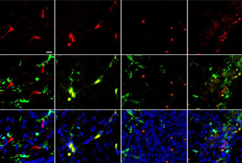 Microglia activity seen in red, green and blue.